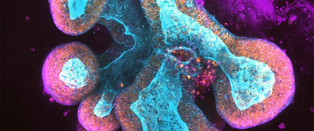 Microscopy image with a black background. There are organoids marked with pink, purple and blue tags