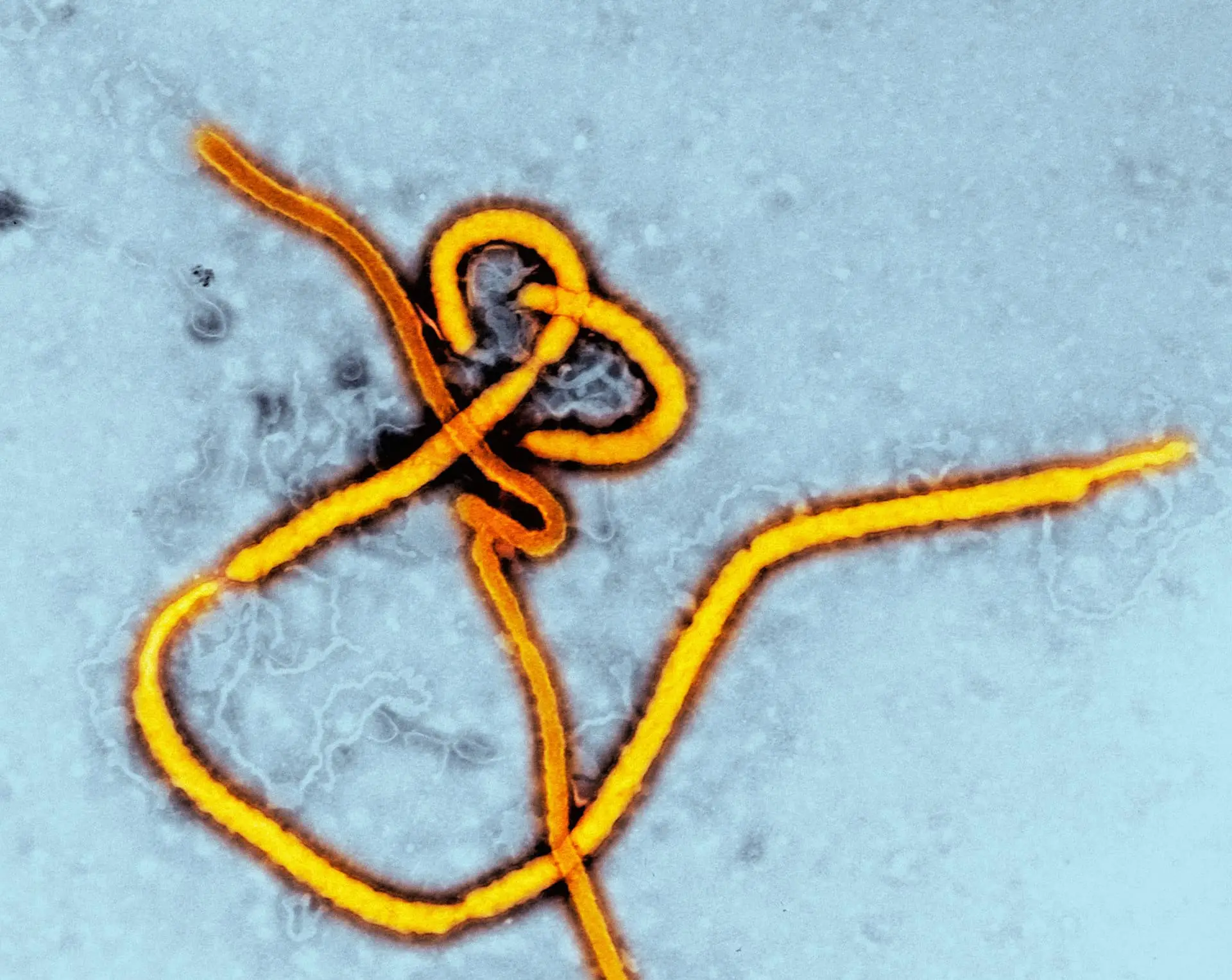 Image of Ebola virus (colored yellow) under a microscope