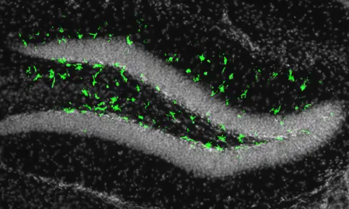 Microscopy image showing immune cell responses to Zika virus.