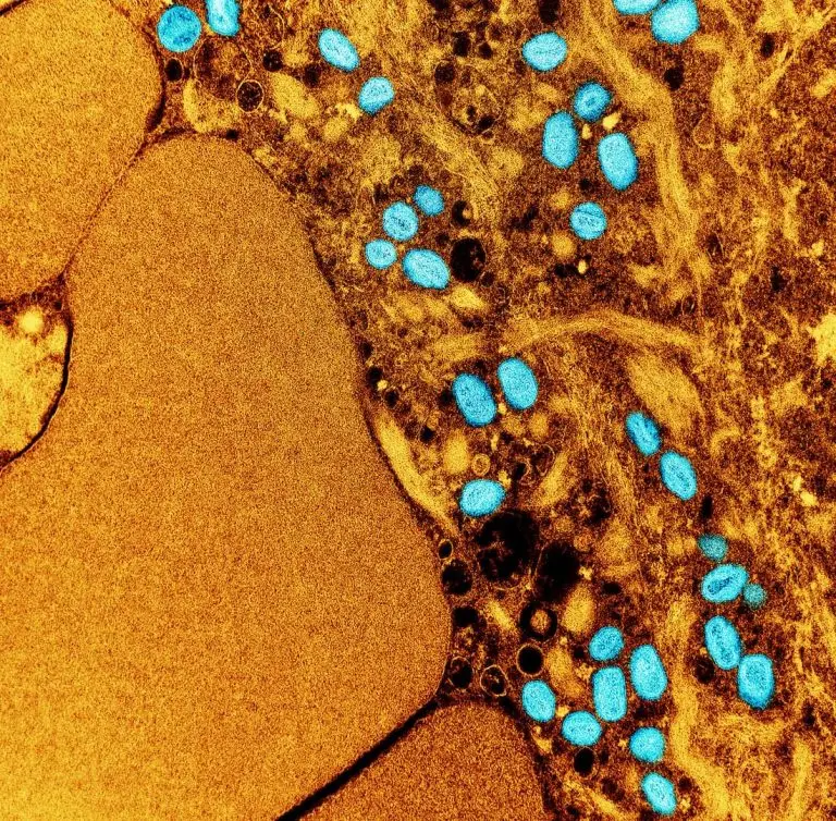 Colorized transmission electron micrograph of mpox virus particles (teal) found within an infected cell (brown), cultured in the laboratory. Image captured at the NIAID Integrated Research Facility (IRF) in Fort Detrick, Maryland. Credit: NIAID