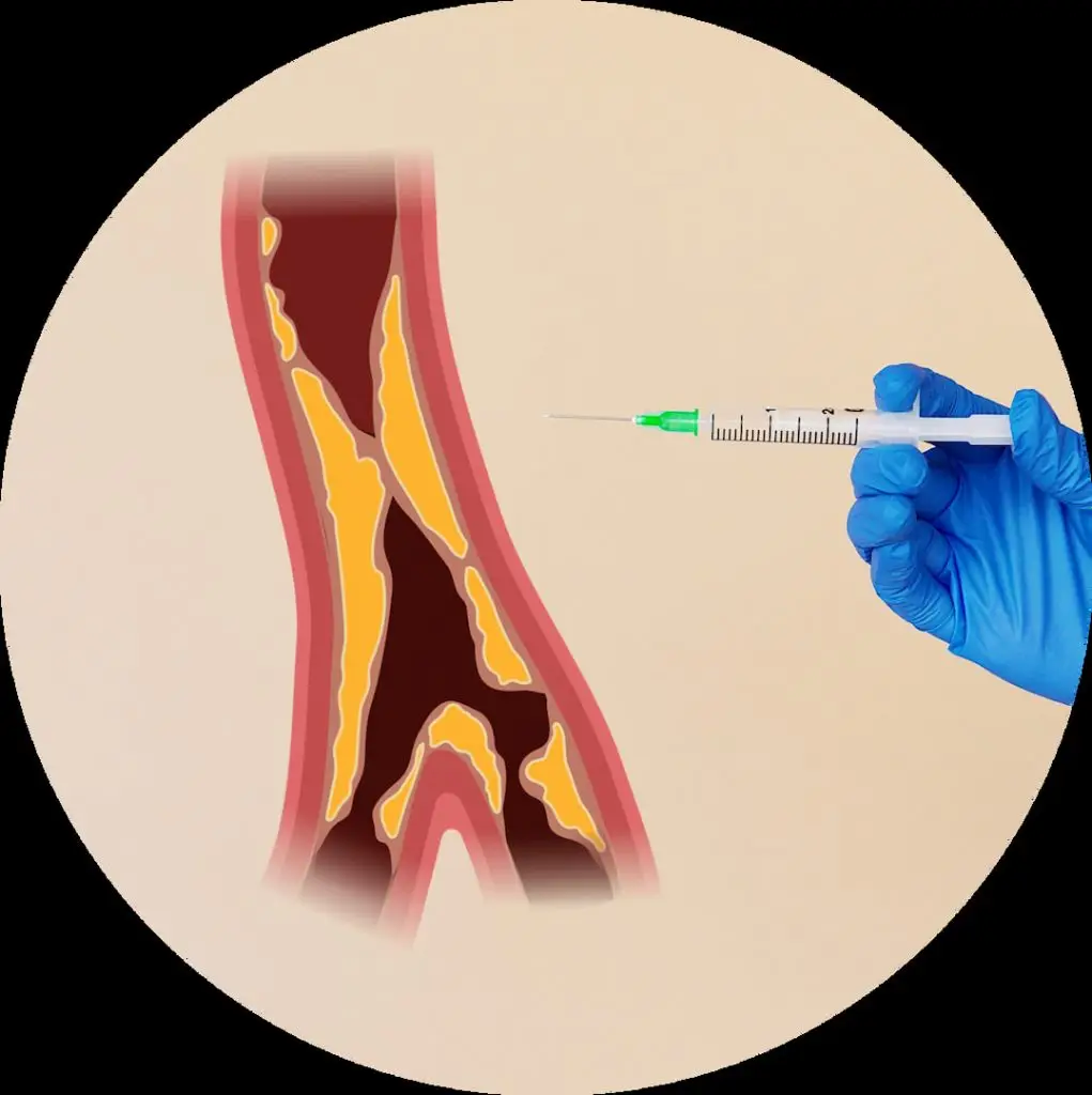 Graphic of a gloved hand offering an injection in a medical setting. The injection is aimed toward a blood vessel with cholesterol plaques