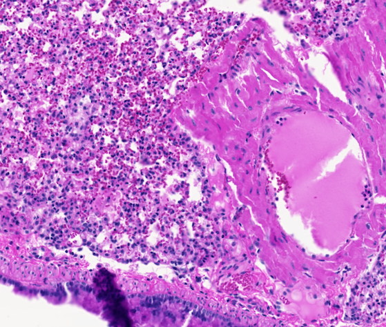 An H&E stained image with pink tissues and purple cells