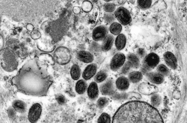 Microscopy image of cells. Shown in black and white