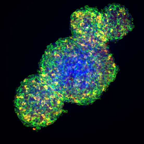 Microscopy image of cells marked with green, red, yellow or blue florescent tags