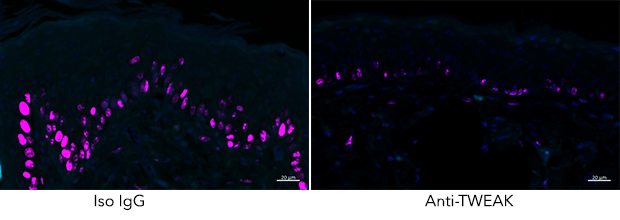 Two microscopy images with a background. There are cells glowing florescent purple. There are more cells in the Iso IgG image than in the Anti-TWEAK image