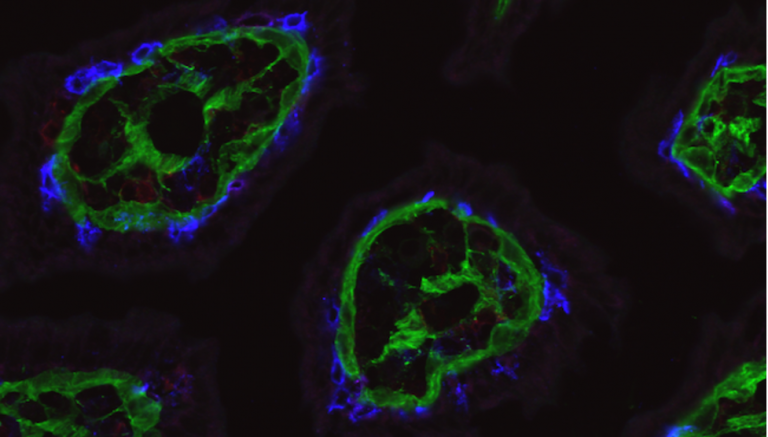 Microscopy image with a black background. There are intraepithelial cells and collagen marked with green and blue florescent tags