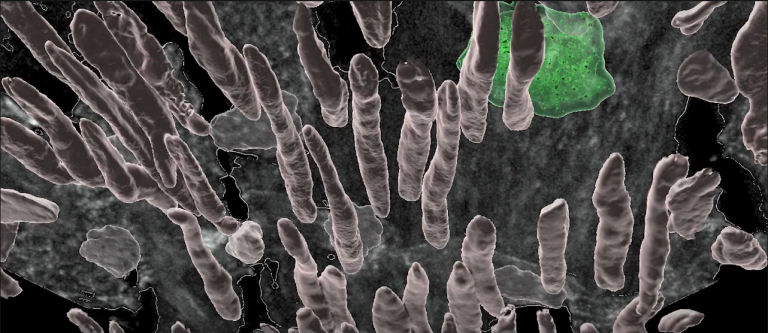 Computer-generated rendering of microphages in an artery wall