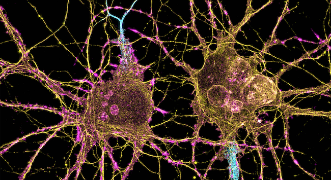 Microscopy image of neurons