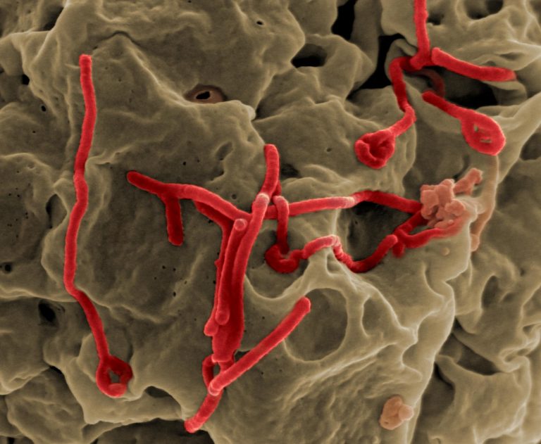 Image of Ebola virus on a cell surface