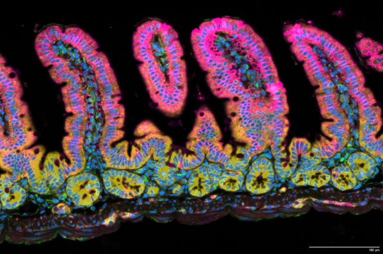 Microscopy image with a background. Cells are colored in shades of pink, blue, orange, green, red, and blue to depict differences in gene transcription.