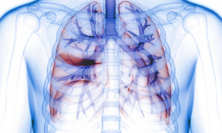 Computer-rendered image of lungs inside a transparent human torso